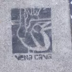 SF Haight Vena Cava 01