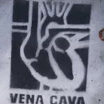 SF Haight Vena Cava 02