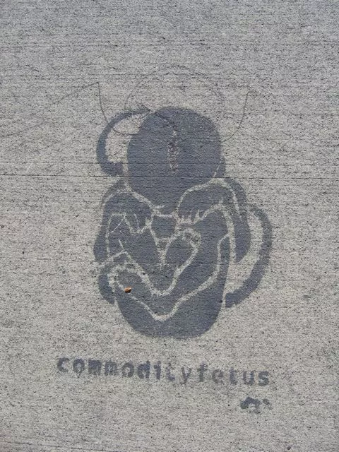 CA Vancouver Commodity fetus