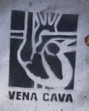 SF Haight Vena Cava 02